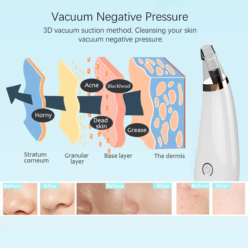 Blackhead Remover Acne Pore Cleaner Vacuum Electric Nose Face Deep Cleaner Pimple Remover Suction Facial Diamond Skin Care Tool