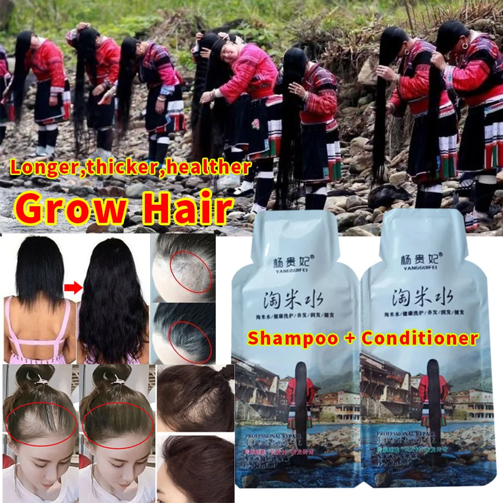 Rice Hair Growth Shampoo Anti Hair Loss Treatment Serum Fast Growth Longer thicker Hair for Men Women Natural Hair Care Product