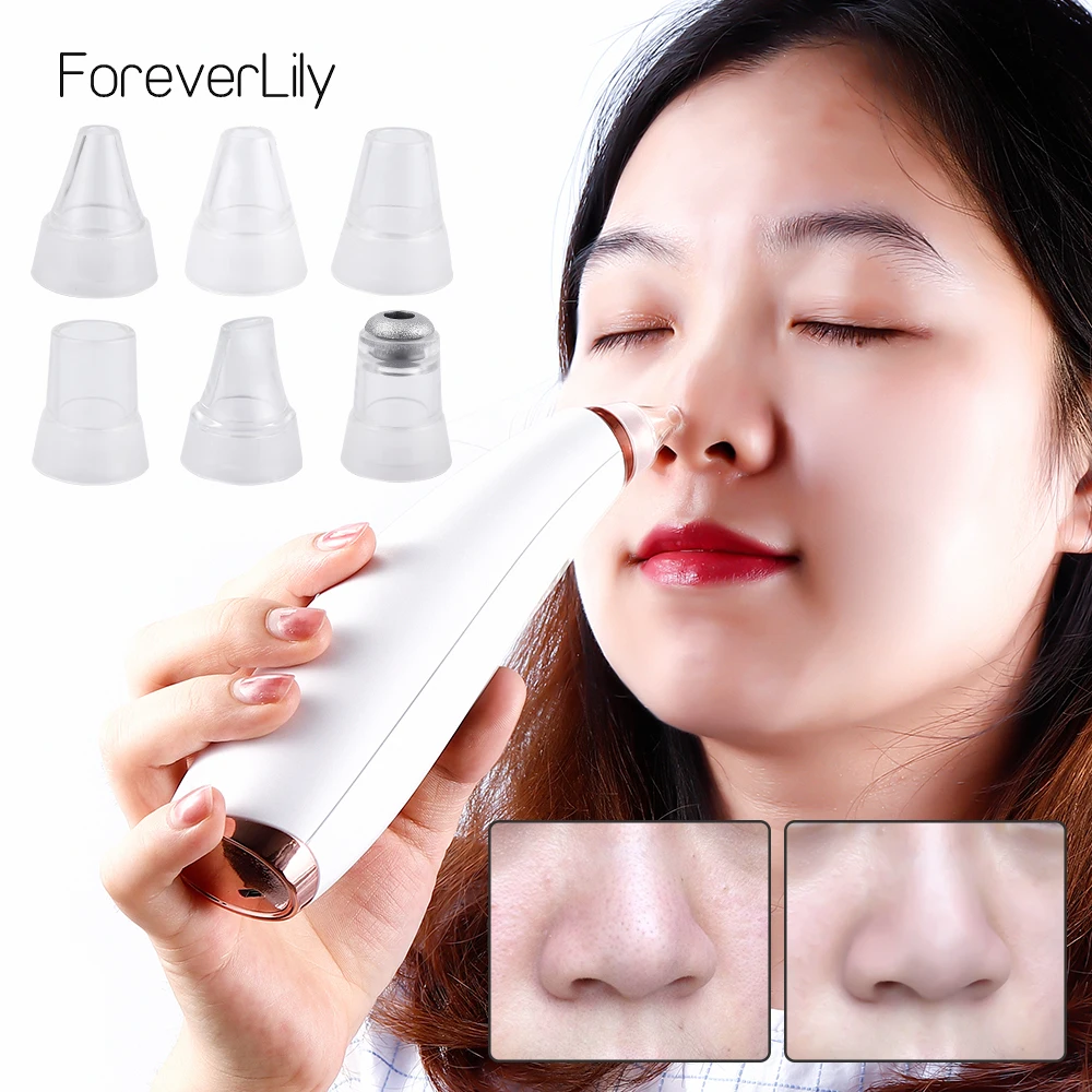 Deep Blackhead Acne Removal Vacuum Dark Black Head Face Skin Cleaner Nose Pore Pimple Care Suction Skin Extractor Cleansing Tool