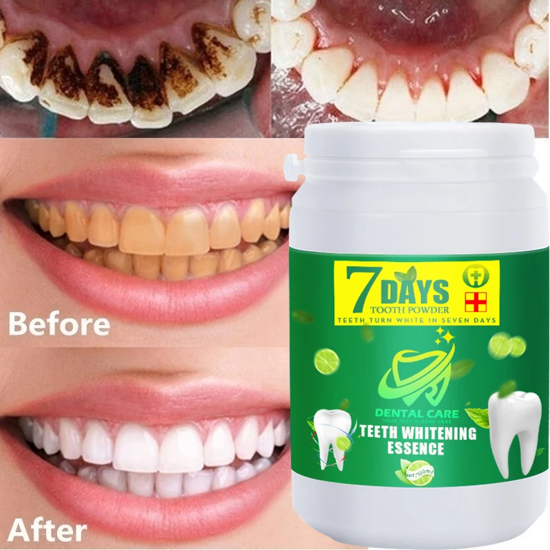 Tooth whitening tooth powder 100g, remove smoke stains, coffee stains, tea stains, freshen bad breath, oral hygiene, dental care