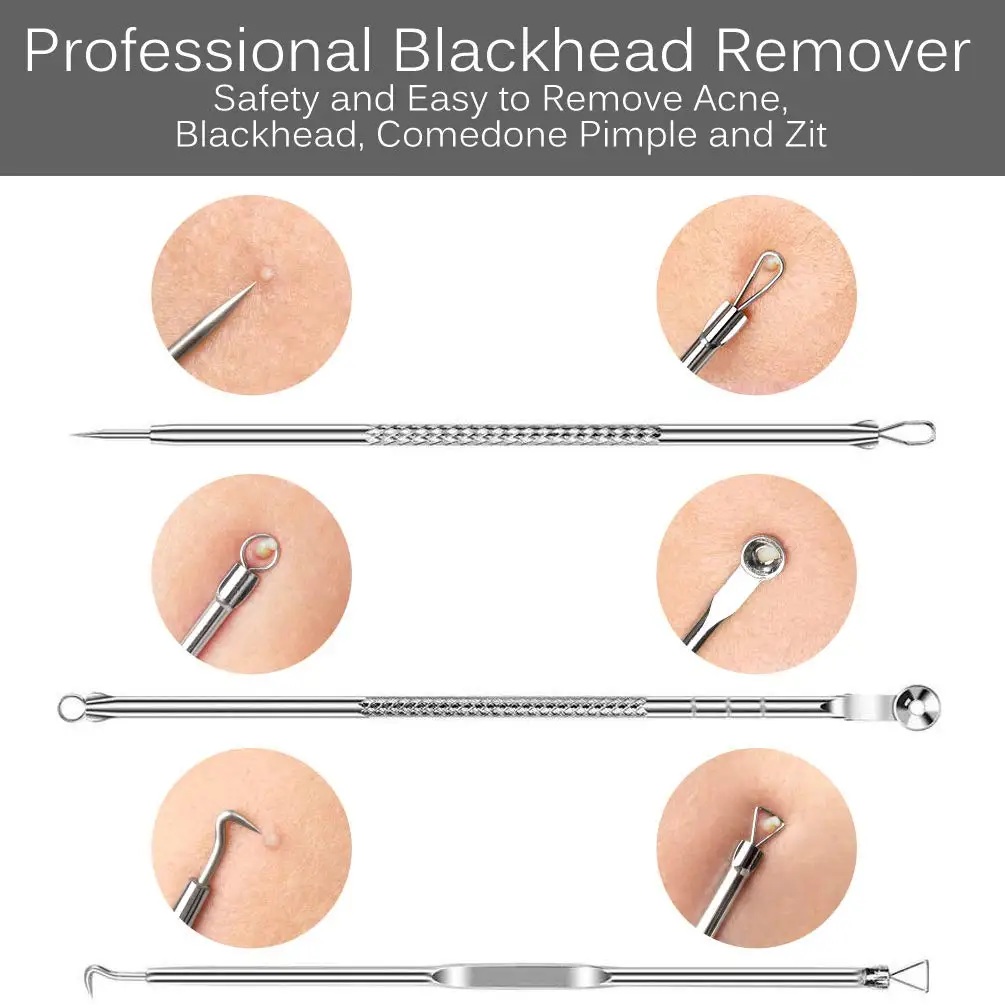 Zit removal deals