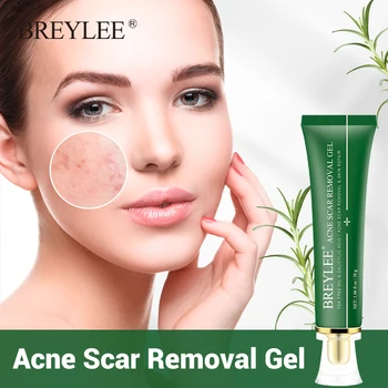 

BREYLEE Acne Scar Removal Cream Fade Acne Marks Spots Gel Soothing Prevent Pigmentation Repairing Gel Pimple Pits Removal
