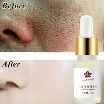 

Essence shrink pores tightening oil control moisturizing remove blackhead anti-wrinkle skin care products