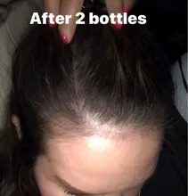 Crecimiento del cabello Aceites esenciales Esencia Anti Pérdida del cabello Productos Cuidado de la salud Belleza Crecimiento más rápido Crecimiento denso Cuidado del cabello Suero líquido