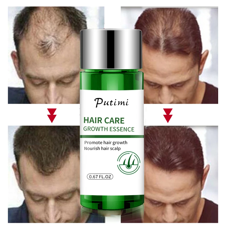 Hair Growth Essence Oil Hair Care Beard Growth Serum Anti-hair Loss Products Thicker Longer Hair Growth Serum Hairs Care 20ml