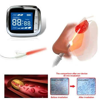 

Physical Rehabilitation LLLT Laser Wrist Semiconductors Acupuncture Diabetes Medical Therapy Watch