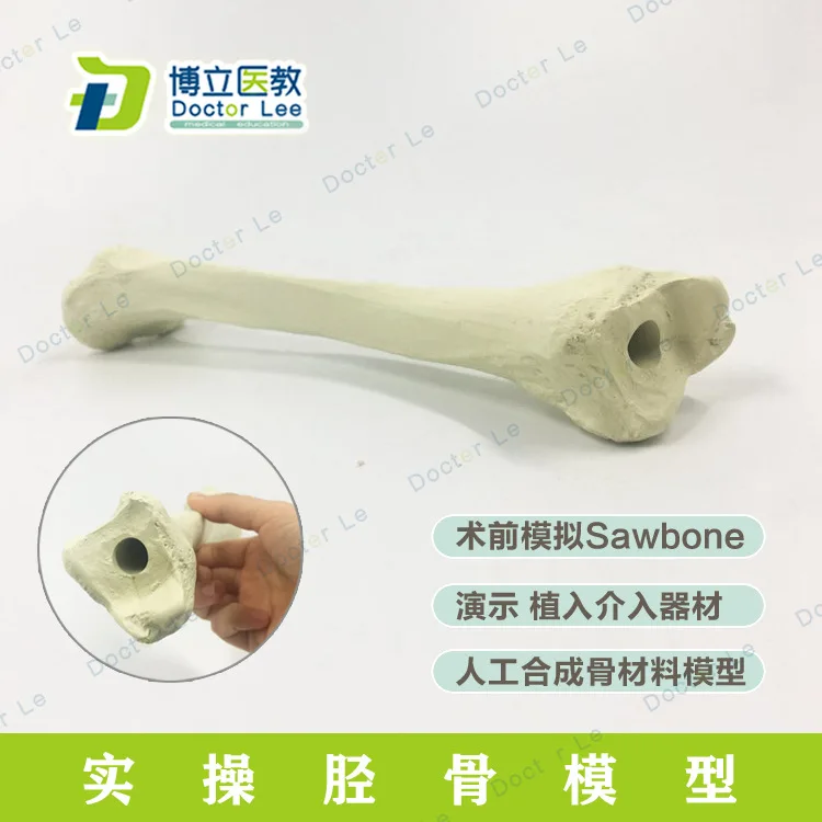 1:1 Life Sized Tibia Orthopedic Implant Model Simulation Bone Demonstration Sawbone Synthetic Before Surgery |