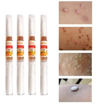 

(4 Pcs/Set) Wart Remover 4PCS/Box Tag Remove Pen Wart Quick Removal Unisex Wart Removal Remover Long-Term Wart B6C0