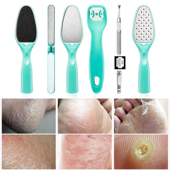 

8 Pcs Foot Scraper Set Heel File Grater Foot Kit Pedicure Scraper Remover Stainless Steel Cuticle Foot Skin Callus Remover