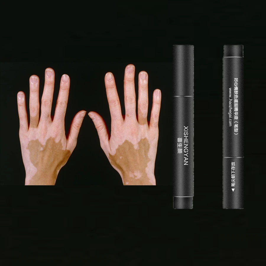 

Leukoderma Covering Pen Waterproof Vitiligo Concealer Plant Essence Liquid for Body Face Hidden Discolored Skin Patches Coverup