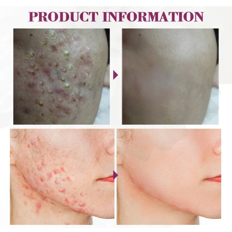 HTB1.mDMMhTpK1RjSZFMq6zG_VXa5