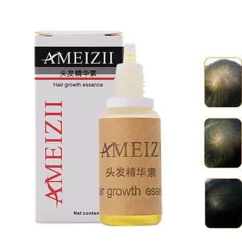 

Ginger Hair Care Essence Treatment For Men And Women Hair Loss Fast Powerful Hair Growth Serum Repair Hair root