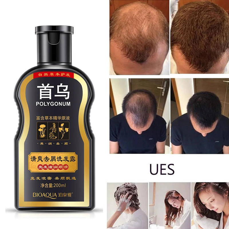 Hc25e072f0d314ea9bcbacfaa56c74c53T