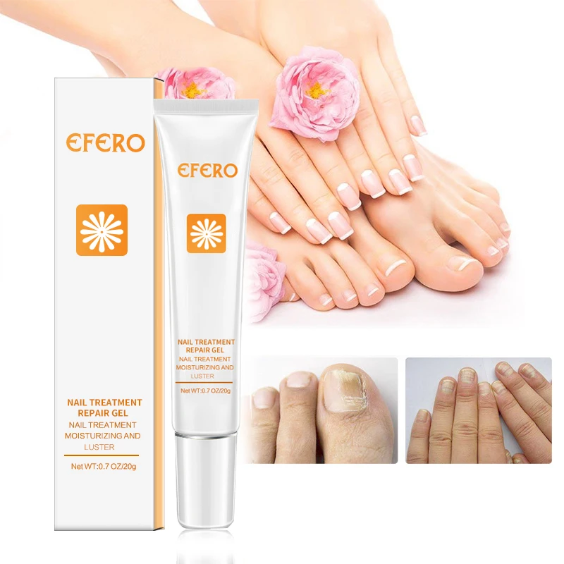 

1/2PCS Nail Fungus Removal Cream Treatment Onychomycosis Paronychia Anti Infection Feet Toe Nail Care Gel Fungal Nail Product