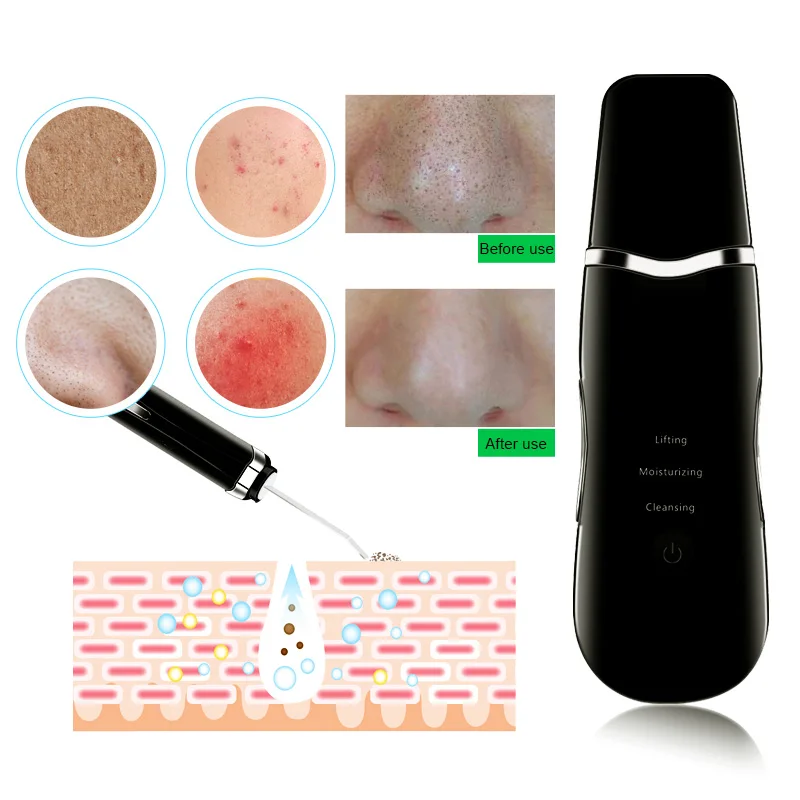US $20.96 Ultrasonic Skin Scrubber Facial Spatula Deap Cleaning Skin Peeling Face Cleaner RF EMS LED Beauty Device Spray Skin Care
