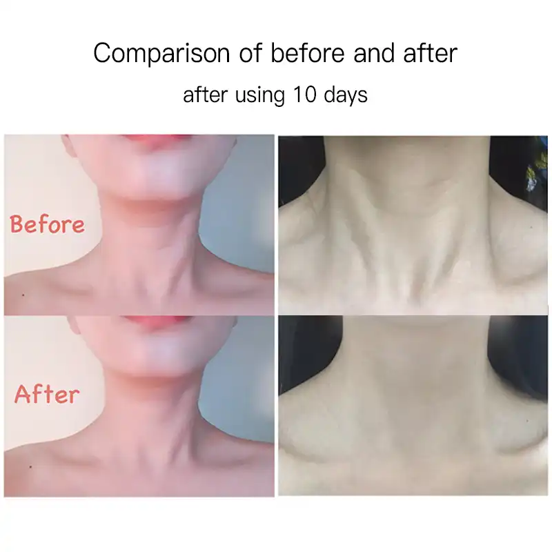 韓国 Dermafirm 高度な抗シワ抗老化マルチペプチド首リフティング引き締めネッククリーム 40 グラム 顔用セルフタナー ブロンザー Aliexpress