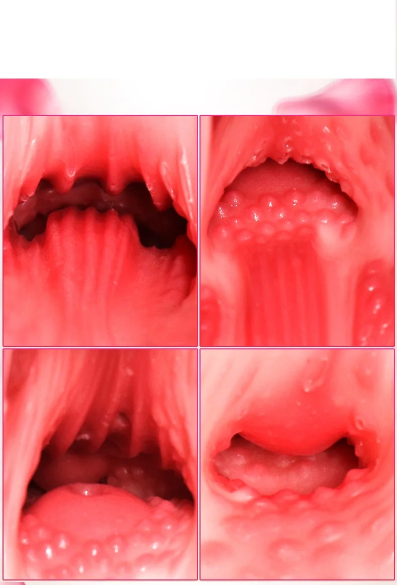 1(18)