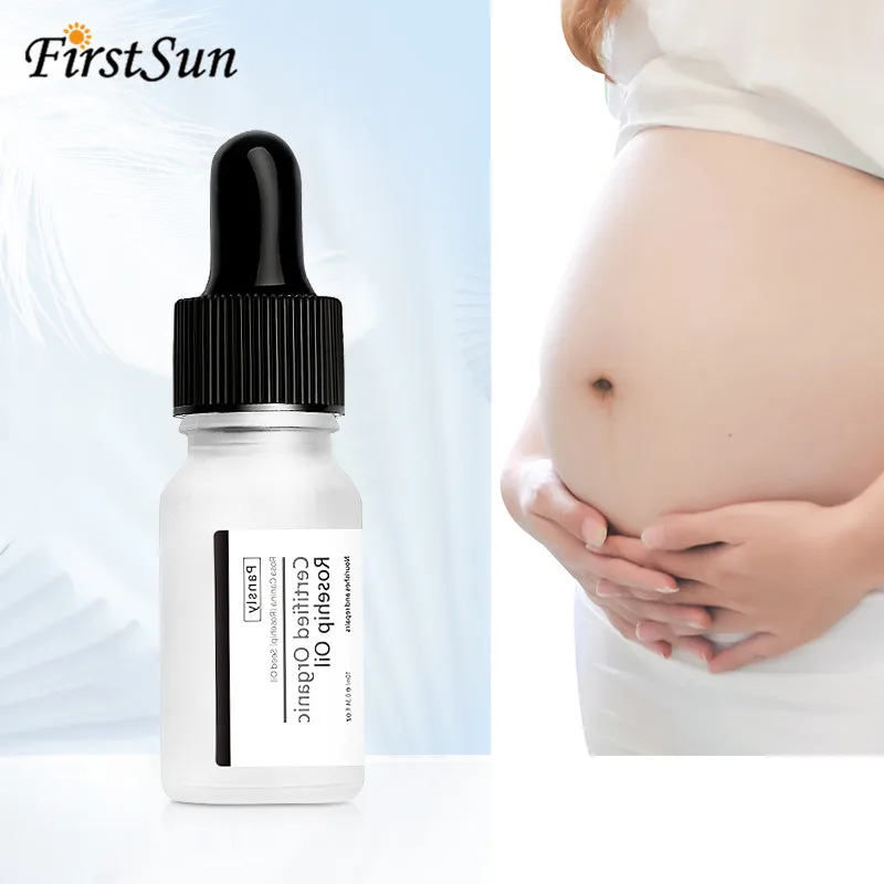 stretch marks remover