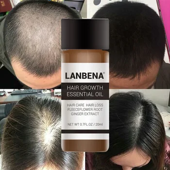 

LANBENA 20ml Hair Growth Essence Damaged Hair Repair Growing Serum Hair Care Essential Oil Preventing Hair Loss Products Unisex