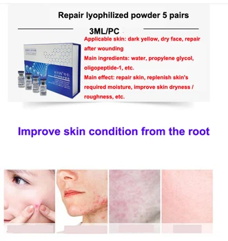 

Skin Rejuvenation Serum Acne Treatment Repair Factor Lyophilized Powder Face Skin Care Ageless Serum Face Cream