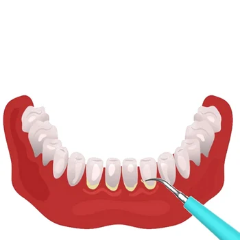 

53.6g Teeth Whitening Tooth Stain Remover Tartar Scraper High Frequency Vibration Dentist Tools