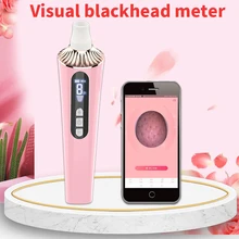 

The New Visual Blackheads Remover Acne Blackheads Artifact 20 Times Magnification Pore Cleaner