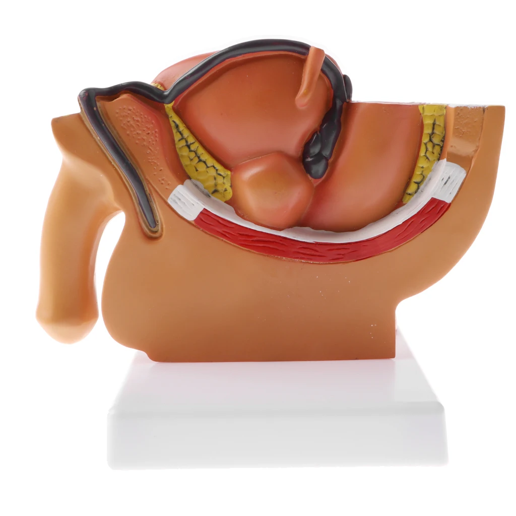 Male Pelvis Anatomical Model with Prostate, 1:2 Sagittal Section