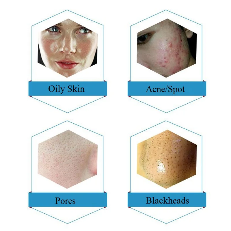 50ml 3 Bottle/Set Clean Solution Solution Facial Serum For Dermabrasion Skin Care Machine