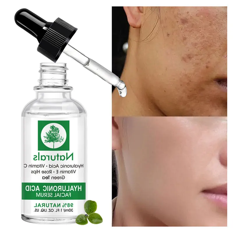 

Hyaluronic Acid Moisturing Facial Serum Vitamin C Whitening Face Essence Green Tea Acne Treatment Oil-Contol Deep Purify Pores