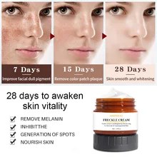 50ml Freckle Cream Whitening Face Cream for Dark Skin Brighten Skin Tone Fade Dark Spots Melanin Correct Pigmentation Skin Care