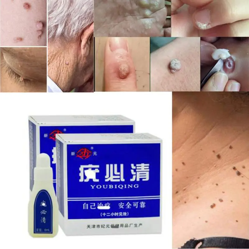 

Mole & Skin Tag Repair Solution Painless Dark Spot Remover Face Wart Tag Freckle 6ml D5BF