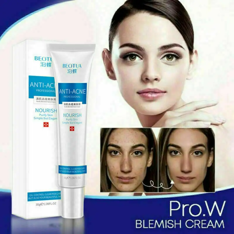

Pro.W Blemish Cream Spots Removal Treatment Pimple Ointment Scar Mark