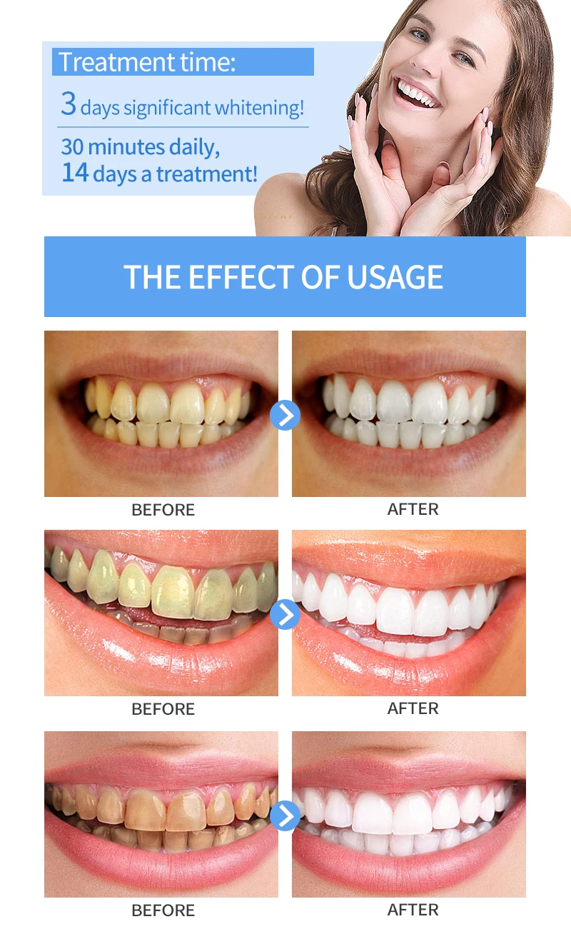 BB-牙齿美白详情_06