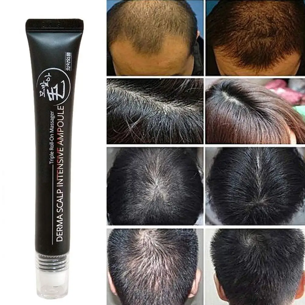 

20ml Hair Line Growth Serum Derma Scalp Intensive Ampoule Hair Fast Roll Triple Massager Essence Loss Regrow Hair K3W7