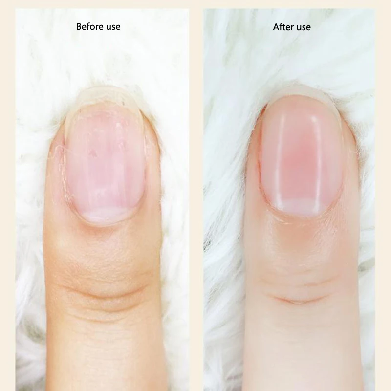 5 in 1 Mini Multifunction Electric Nail Drill Polisher Remover Grinding Machine Dead Skin Removal Pedicure Manicure Tools 5 in 1 Mini Multifunction Electric Nail Drill Polisher Remover Grinding Machine Dead Skin Removal Pedicure Manicure Tools