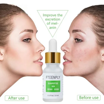 

Oligopeptide Red Blood Solution Facial Serum Brightening And Moisturizing Fine Pores Delicate And Smooth Skin