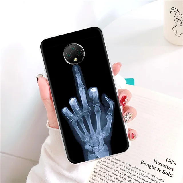 Doogee N20 Pro Case For Doogee N10 X20 X60L Y6 Y8C Y9 Plus Case Silicone Cartoon Back Cover on Doogee X60L X 60L Phone Bumper U024