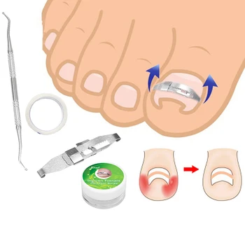 

1Set Ingrown Toenail Correction Tool Ingrown Toe Nail Treatment Inset Buckle Pressure Sensitive Tape Twillizer Pedicure Tool