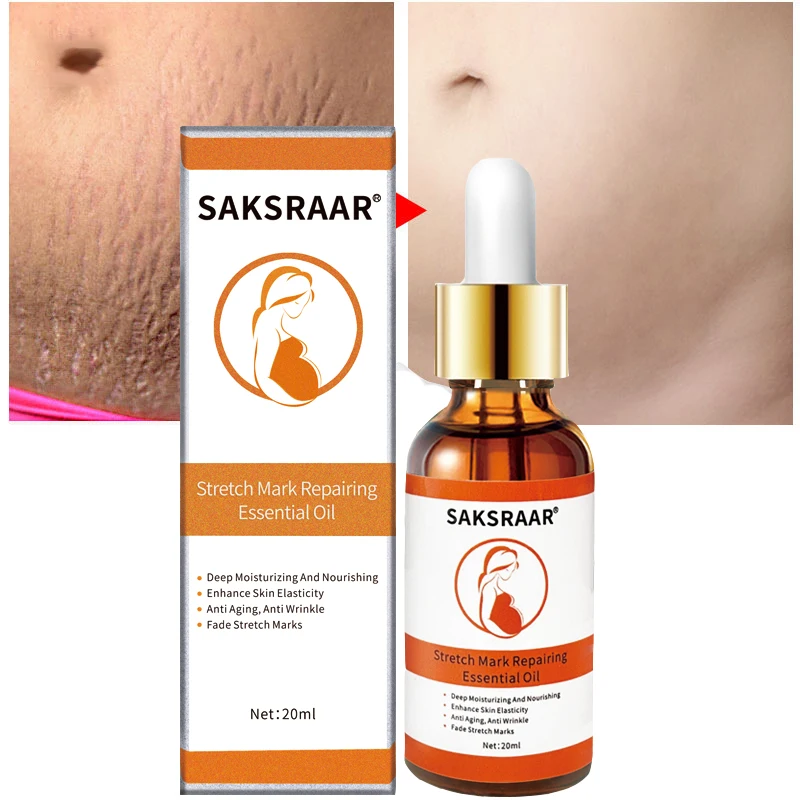 Средство для удаления растяжек JoyPretty, масло для беременных, уход за ...