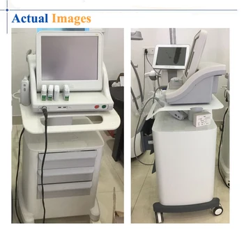 

Factory price ultrasonic facial lifting anti-wrinkle and body firming machine with 4.5mm,3.0mm,1.5mm,8.0mm,13.0mm cartridges
