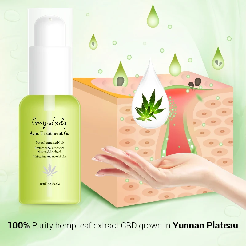 2 шт OMY LADY Acne Treatment Сыворотка для лица + удаление веснушек крем удаления пятен