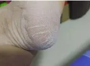 Recortador eléctrico de piel dura para pies, herramienta recargable para el cuidado de los pies, removedor de callos