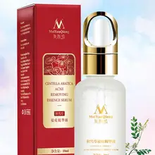 Зимнее растение для удаления от акне восстанавливает эссенцию мазь для лечения шрамов шрамы регенерация кожи выцветает от акне растительных экстрактов