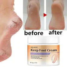 Chapped Hands And Foot Repair Hand Cream Moisturizing Skin Whitening Winter Hand Skin Care
