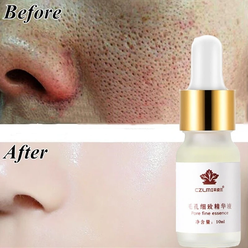 

Hyaluronic Acid Pore Treatment Serum Essence Shrink Pores Relieve Dryness Oil Control Firming Moisturizing Repairing Skin Care