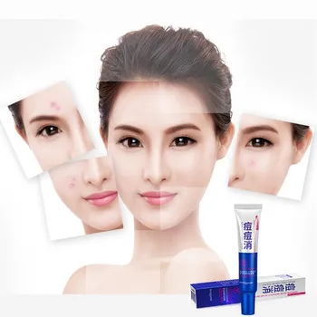 

Anti Acne Cream Oil Control Shrink Pores Acne Treatment Scar Remover Face Care Pure Plant Natural Skin Care Product 30g