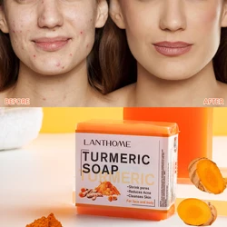 Anti-acne Turmeric Soap Cleans Skin Remove Mites Shrink Pores For Bath Handmade Natural Skin Whitening Soap Anti-inflammatory