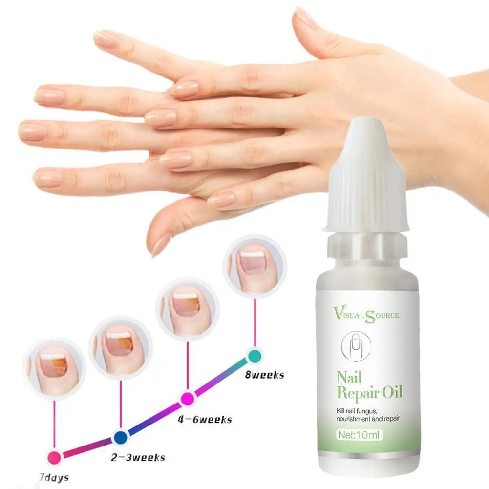 

10ml Nail Repair Liquid Treatment With File Nail Anti Care Nail Liquid Nail Safe Nail Fungu Onychomycosis Remove Polish Toe W4S3