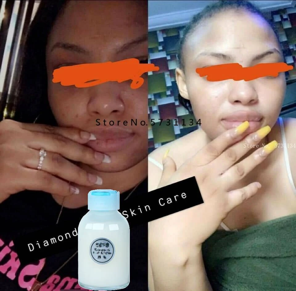 bleaching serum