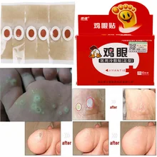 6 Штук Медицинской штукатурки прокладки для удаления ноги пластырь с кукурузным крахмалом омертвевшей кожи мозолей удаления Детокс ног пластырь